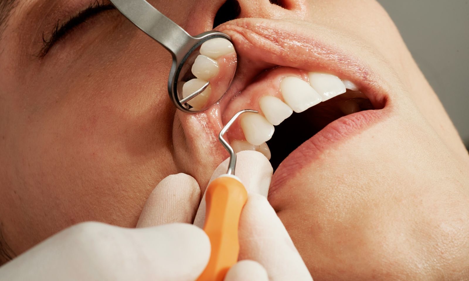 Conservativa & Endodonzia